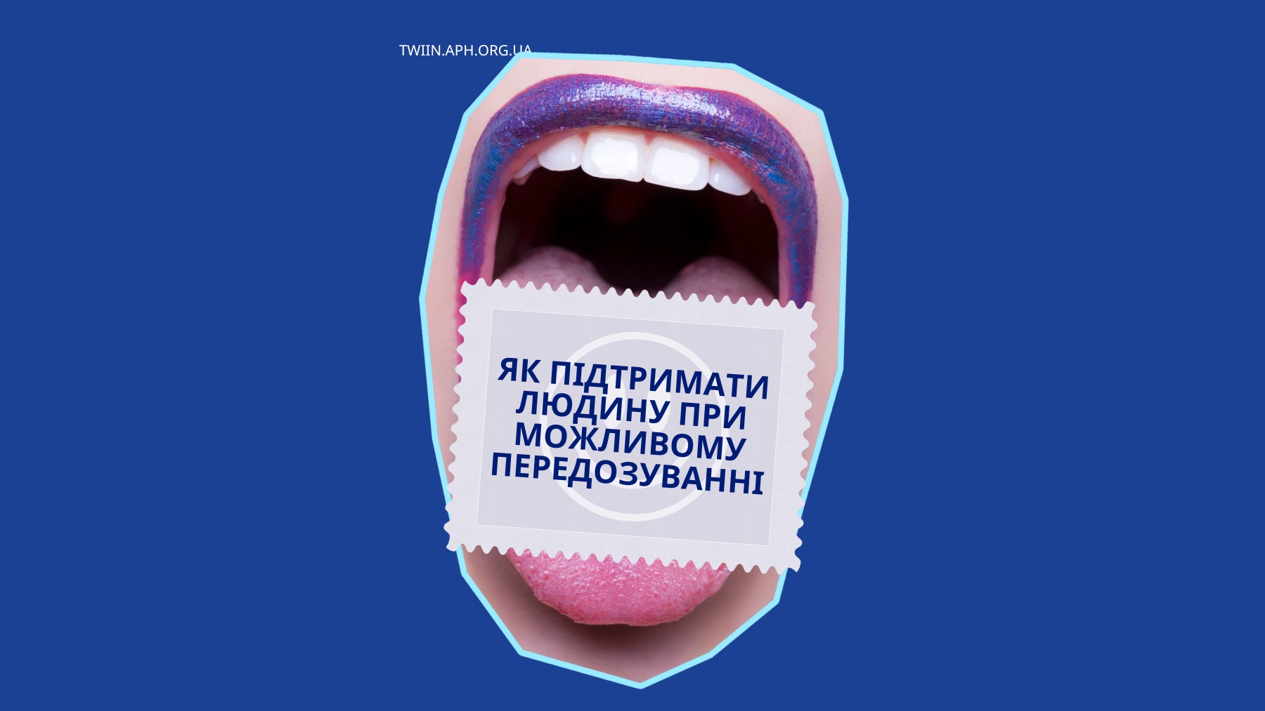 Перша допомога при передозуванні: інструкція, як врятувати життя | TWIIN